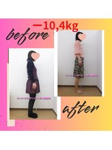 スーパースリムダイエット茅ヶ崎 茅ヶ崎整体院/3ヵ月－10,4ｋｇ減ダイエット♪