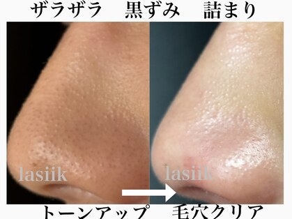 ラシーク(Lasiik)の写真
