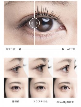 エムプラス 南森町(m+)の写真/マツエクとまつ毛パーマの良いとこどりの新技術！【&Healthyフラット100本×ラッシュリフト¥9500】