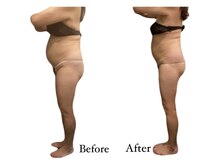 アールユー ギンザ(Ryou ginza)/30代～の本気痩身！諦めていた方