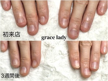 グレースレディ 大阪店/(深爪/長さだし/フィルイン/)