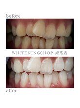 ホワイトニングショップ 姫路店/ホワイトニング