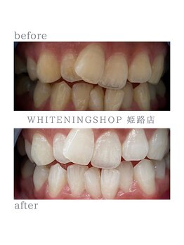 ホワイトニングショップ 姫路店/ホワイトニング