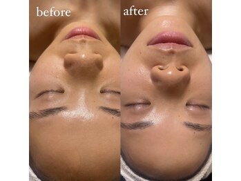 ココビ 東尾道店(COCOVI)/シーズナルエステ Summer