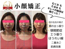 プレフェランス(Preference)の雰囲気（小顔/たるみ/リンパ/コルギ/フェイシャル/デトックス/ニキビ）
