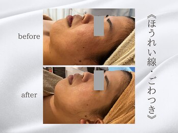 ジュプン 長崎/クリスタルパックの変化。