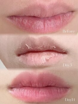 チャームプラス(CHARM+)/【ローマピンク】