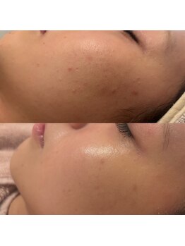 エクラ(eclat)/クリスティーナ