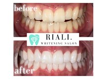 リアリ 宮崎(RIALI.)/劇的ビフォーアフター☆