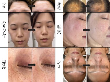 サンサンサロン 淀屋橋店(33salon)の写真