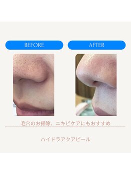 ムーンライズ(moonrise)/