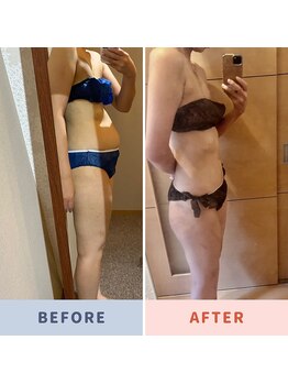 ケンビラク(Kenbiraku 健美楽)/お得意様カーヴィー炭酸お腹44日