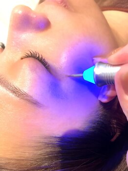 シミしわ改善！予防ケア