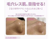 ナチュラ ソース(NatureSouce)の雰囲気（肌質改善に本気の方へ◎その場しのぎじゃない根本フェイシャル ）