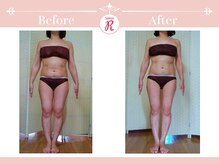 サロン アール(Salon R)/痩身施術×食事・インナーケア