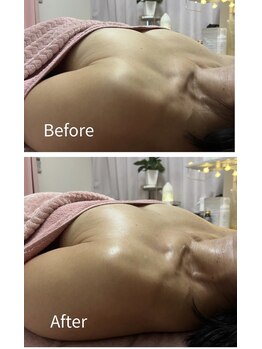 チュラ 大宮店(Chura)/【50代】初回バストアップ/大宮