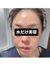 ヒール(heal)/ツヤ爆弾エステ