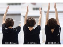 ジェイミープラス 表参道(J‘aimee +)/肩甲骨ビフォーアフター