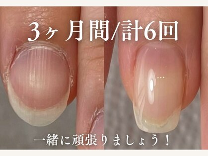 ツナミ(Tsunami)の写真