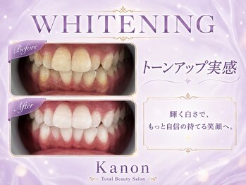 カノン 南熊本店(Kanon)の写真/歯の着色や黄ばみ、口臭改善！仕事帰りでも通えるサロンでホワイトニング￥3000～◎