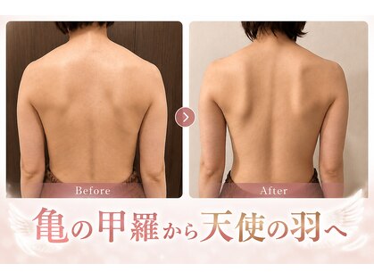 バービーグロウ 恵比寿(Barbie Glow)の写真