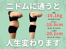 ニドム