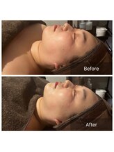 カンコルギセラピー 広島幟町店(KAN)/