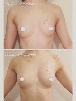 アンド ユー(and.yu)/★お客様症例★