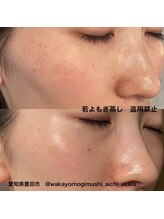 マロカ(Marroka)/【バラエティ蒸しの結果6】