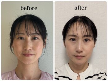 かぐや(salon)/ビフォーアフターのお写真