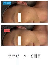 ユフラ(Juhla)/ララピール