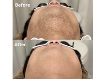 ラティア(Ratia)/