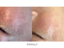 サロン アンネ(Anne)/プラズマニア