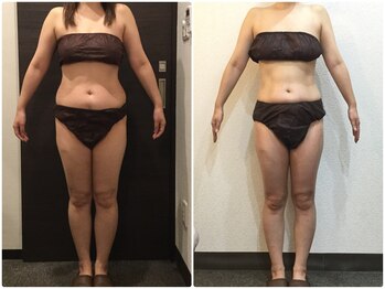 美容整体ウェリナ あま甚目寺院/小顔矯正/骨盤矯正/美脚サロン