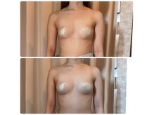 ベルフェム(Bellefemme)の雰囲気（肩首周りスッキリでバストに変化巻き方改善で柔らかい印象へ）