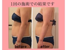 ヨサパーク コクリ(YOSA PARK kokuRi)/たった1回でも実感して頂けます