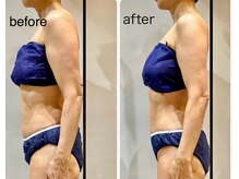 ビンナ 五反田店(Binna)/美容整体