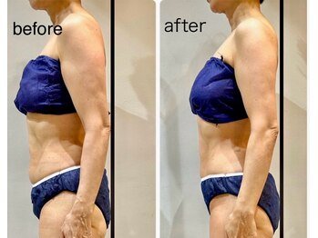 ビンナ 五反田店(Binna)/美容整体