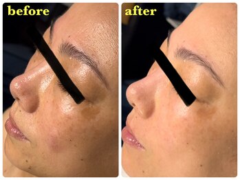 ベルドア(Bell Door)/《なめらかで透明感のある素肌》