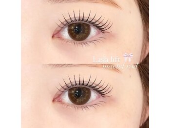 アンフルール 千葉店(Une fleur)/【メーテルロッド】