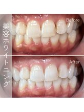 ココビ 津高店(COCO美)/