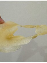 フィー(Fee)/黒ずみと思っていたが毛だった！