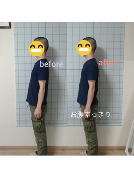 カイロプラクティック よつは/《骨盤調整前後》