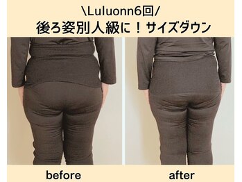 ヨサパーク ルアナ(YOSAPARK Luana)/見た目痩せならルルオン!!