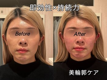 薬手名家 心斎橋店/お客様ビフォーアフター