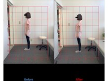 リード整骨院(LEAD整骨院)/姿勢改善、猫背、反り腰