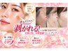 【話題のシミケア】痛みほぼ無し・ベビースキンへ♪ ブログは絶対必見!