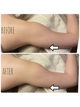 イヴ(Yves)/ハイパーナイフbefore/after