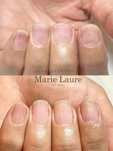 マリーロール 淀屋橋本店(Marie Laure)/自爪育成/深爪矯正/ネイルケア