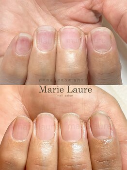 マリーロール 淀屋橋本店(Marie Laure)/自爪育成/深爪矯正/ネイルケア